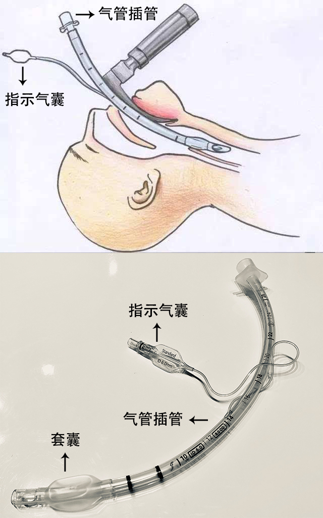 贊！??！250萬(wàn)指示氣囊，客戶100%滿意！